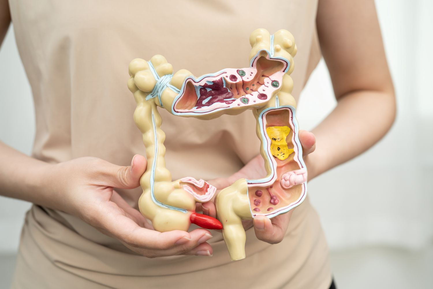 Leaky Gut Explained